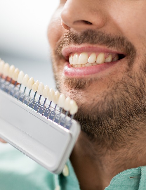 Man's smile compared with porcelain veneers color chart at cosmetic dentistry consultation