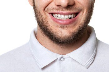 patient with missing tooth smiling