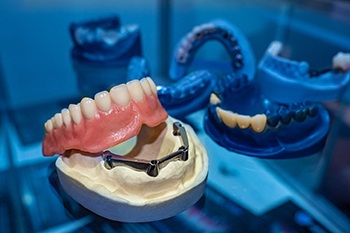 implant dentures in Copperas Cove