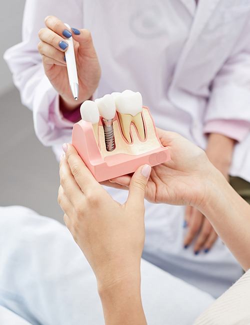 dentist showing a patient a model of how dental implants work