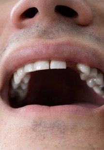 patient looking at dentist while smiling 