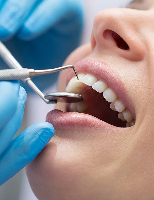 Patient receiving scaling and root planing periodontal therapy