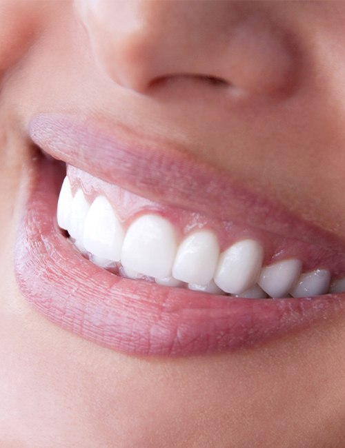 Closeup of healthy smile after fluoride treatment