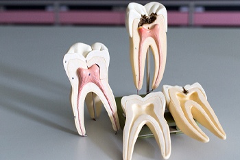 Four model teeth showing canals on gray desk