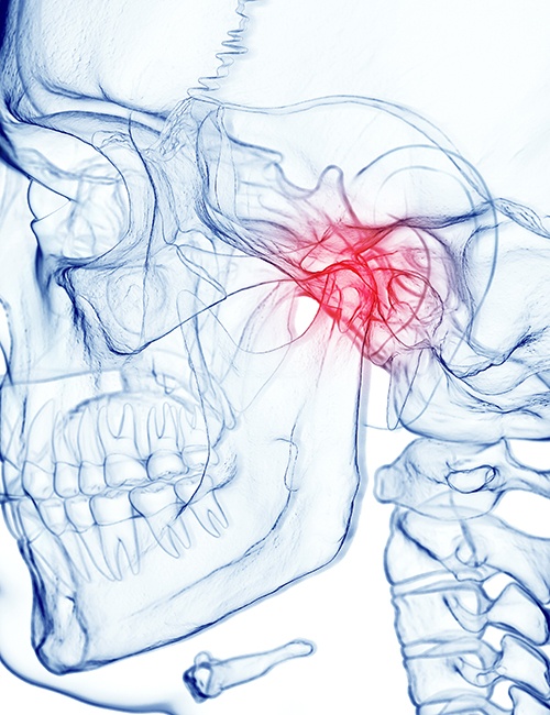Illustration of the TMJ