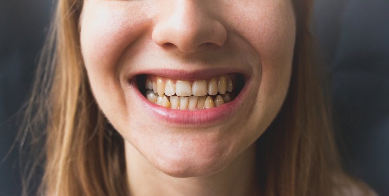 up-close view of bad teeth