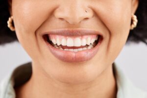 Woman with a white smile